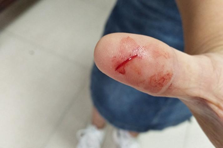 诺阿朗手指严重割伤！ESPN晒照，工作人员对其受伤的地点检查