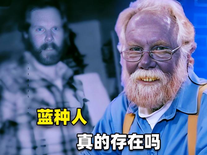 拉卡泽特呼吁法国队征召托利索：蓝色真的很适合他，有人在听吗